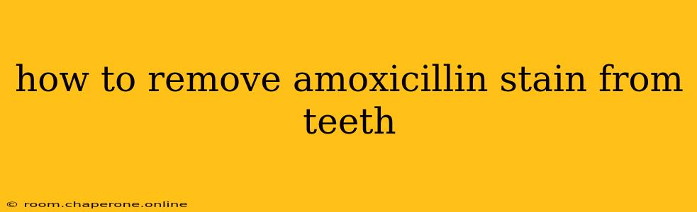 how to remove amoxicillin stain from teeth